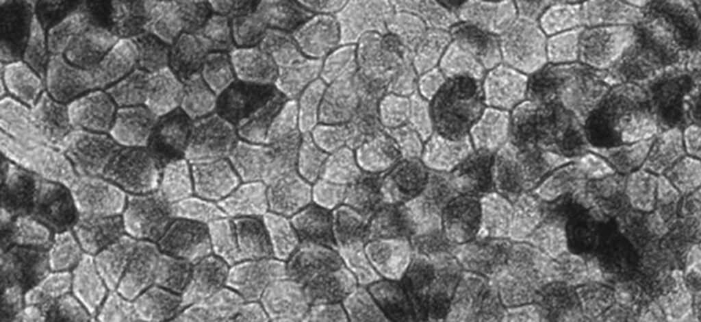 Retinal Pigment Epithelium Cells in Culture